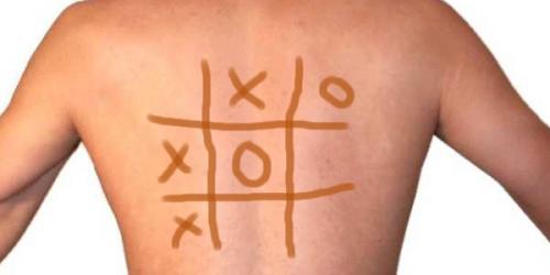 Лечение щитовидки йодной сеткой. Как лечить заболевания щитовидной железы йодом