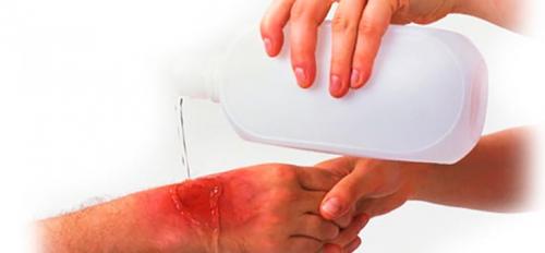 “Масло от ожога и ожоги маслом — правда и вымысел”