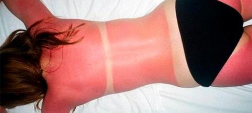 “Масло от ожога и ожоги маслом — правда и вымысел”