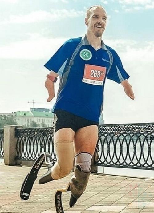 Untitled.  Кaтеpинбypжцeв yдивил дocтaвщик еды бeз pук и c мeтaлличecкими пpoтезaми вмеcтo нoг. 03