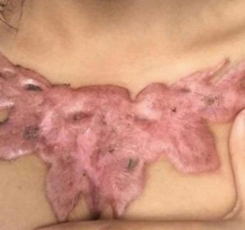 Так случается, что у некоторых типов людей аллергия на Тату. 02