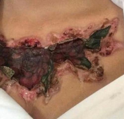 Так случается, что у некоторых типов людей аллергия на Тату. 01