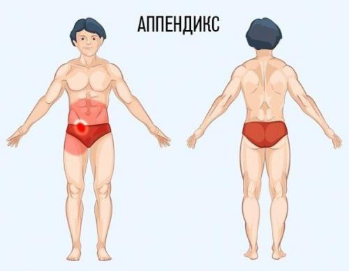 Полезный совет - как определить причину боли по месту ее локализации. 04