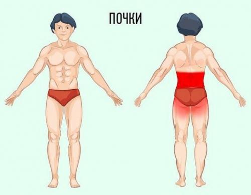 Полезный совет - как определить причину боли по месту ее локализации. 05
