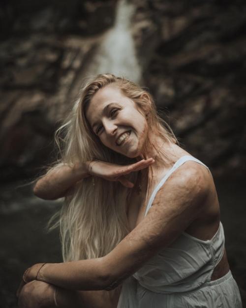 То адское пламя не смогло уничтожить ее женственность и красоту. 01