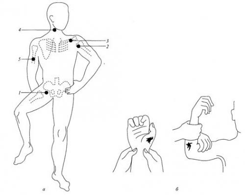 Первая медицинская помощь при кровотечениях. 01 Первая медицинская помощь при кровотечениях. 01