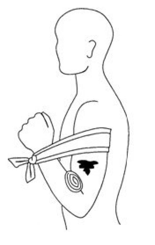 Первая медицинская помощь при кровотечениях. 06 Первая медицинская помощь при кровотечениях. 06