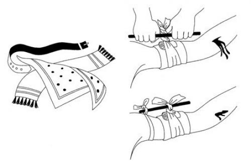Первая медицинская помощь при кровотечениях. 04 Первая медицинская помощь при кровотечениях. 04