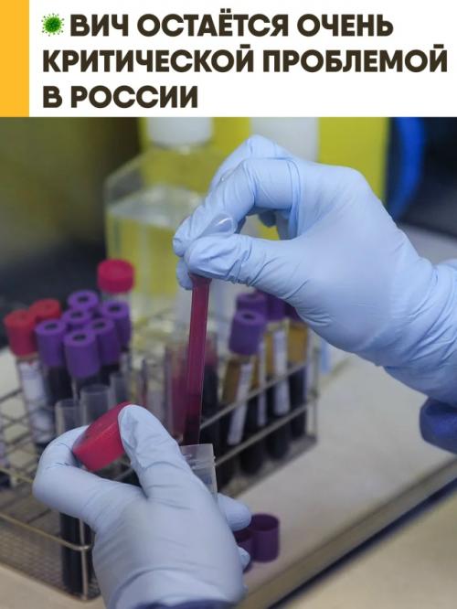 Ситуация с вич в России остаётся критической: по официальным данным, инфицирован каждый сотый россиянин. 

