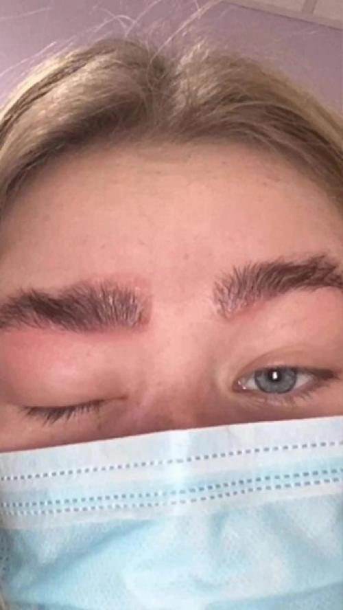 Мне кажется это аллергия. 02