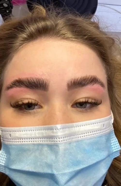 Мне кажется это аллергия. 01