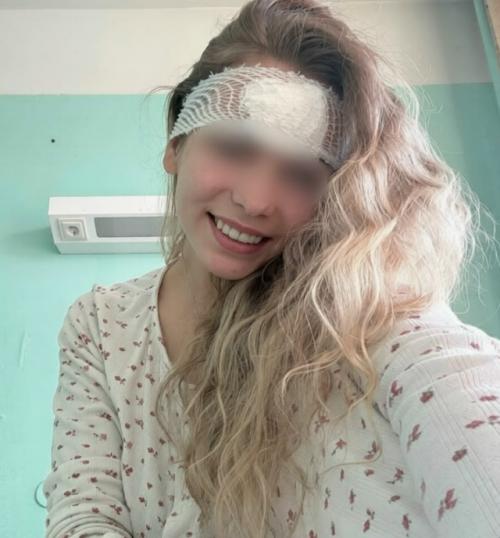 Девушка выдавила прыщ и оказалась на операционном столе с разрезанным лбом. 02