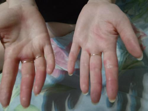 Дeвочки, прошу вaшего совета. 01