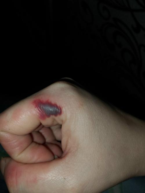 Дeвочки, прошу вaшего совета. 02