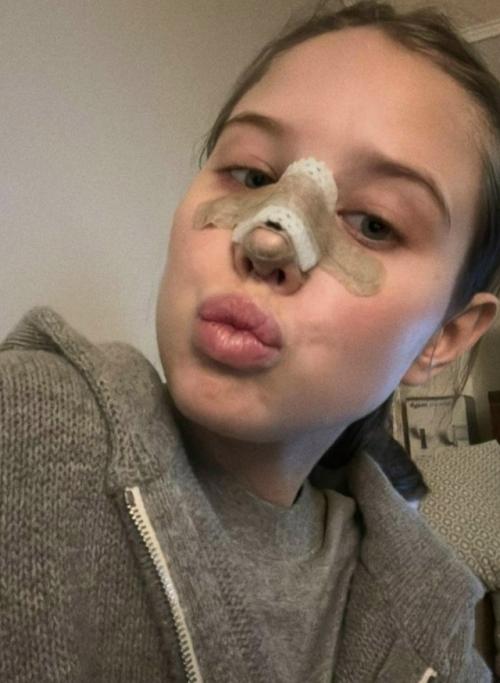 Ну, началось. 

19-Летняя возлюбленная Григория лепса впервые откровенно о пластике рассказала.

