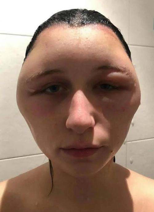 В 2018 году 19-летняя эстель решила изменить имидж и покрасить волосы в тёмный цвет. 02