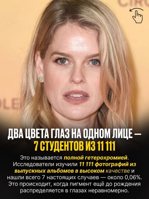 Природа раздаёт людям особенности внешности с такой разницей в шансах, что некоторые почти невозможно встретить. 05
