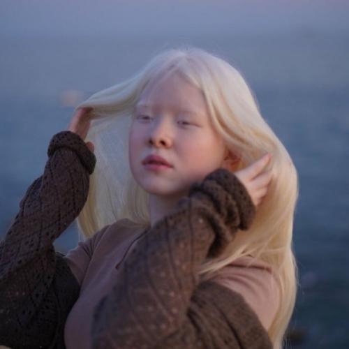 Asel Kalaganova со своей младшей сестрой - альбиносом. 03