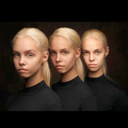 Это очень частая проблема девушек перед свадьбой. 03