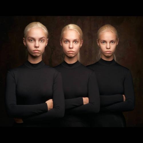 Это очень частая проблема девушек перед свадьбой. 04