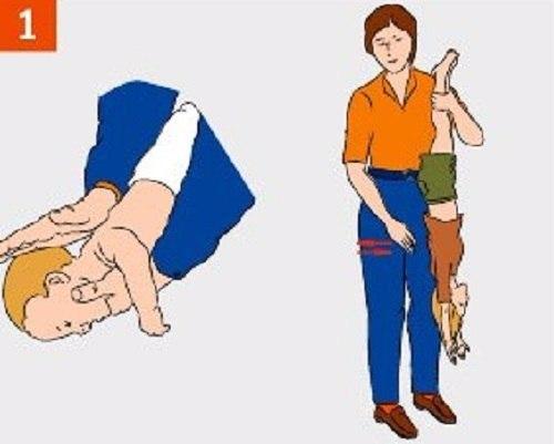 Что делать если ребенок подавился! 02