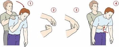 Что делать если ребенок подавился! 05