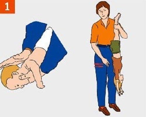 Таким образом, если ребенок подавился, он может умереть. 02