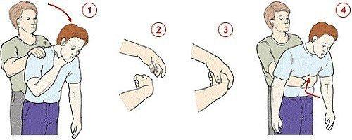 Таким образом, если ребенок подавился, он может умереть. 04