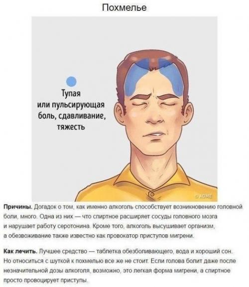 5 типов головной боли и способы быстро от них избавиться. 04