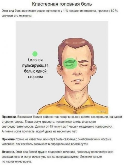 5 типов головной боли и способы быстро от них избавиться. 03