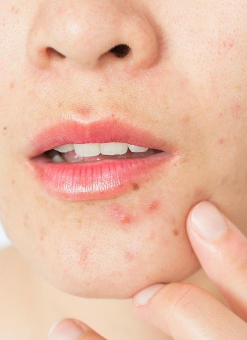 Горсть миндаля в день может заметно улучшить состояние кожи. 02