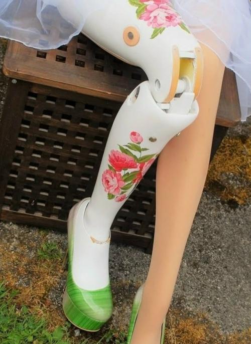 Одни из первых протезов использовали ещё в эпоху древнего Рима. 06