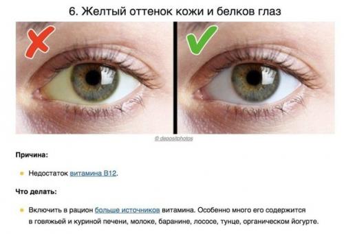 8 сигналов тела, которые помогают понять, каких витаминов не хватает вашему организму. 05