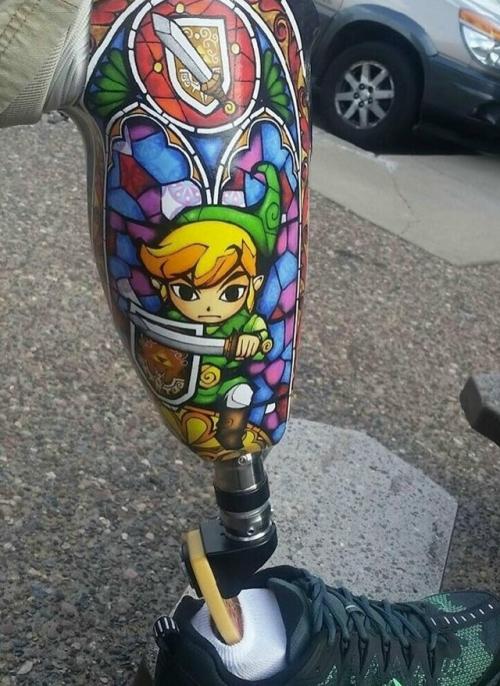 Одни из первых протезов использовали ещё в эпоху древнего Рима. 03