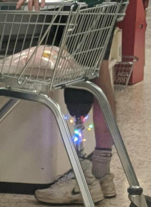 Одни из первых протезов использовали ещё в эпоху древнего Рима. 02