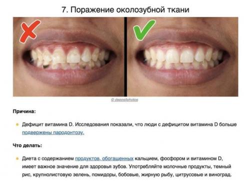 8 сигналов тела, которые помогают понять, каких витаминов не хватает вашему организму. 06